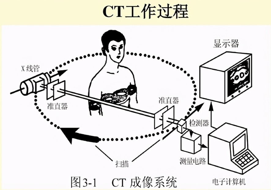 CT扫描仪成像原理