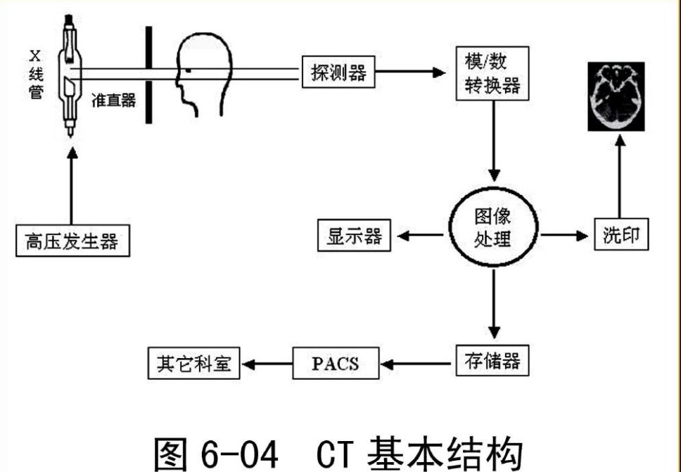 CT结构原理