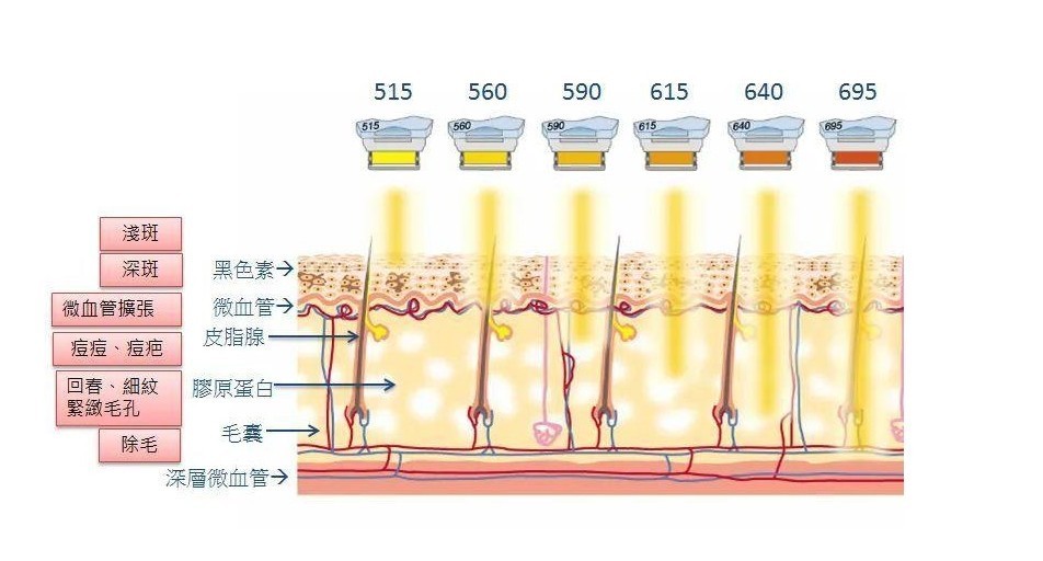 强脉冲滤光片光子美容波段渗透皮肤层